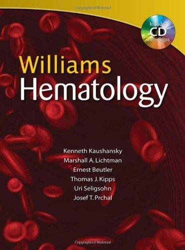 Williams Hematology, Eighth Edition                                                                                                                   <br><span class="capt-avtor"> By:Kaushansky, Kenneth                               </span><br><span class="capt-pari"> Eur:307,30 Мкд:18899</span>
